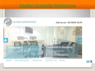 Dental implants Melbourne 
 