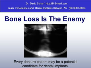 Bone Loss Is The Enemy Every denture patient may be a potential candidate for dental implants. 