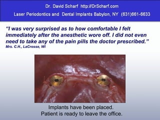 “ I was very surprised as to how comfortable I felt immediately after the anesthetic wore off. I did not even need to take any of the pain pills the doctor prescribed.” Mrs. C.H., LaCrosse, WI Implants have been placed.  Patient is ready to leave the office. 