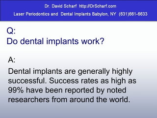 Q: Do dental implants work? A: Dental implants are generally highly successful. Success rates as high as 99% have been reported by noted researchers from around the world. 