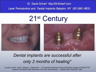21 st  Century Dental implants are successful after only 2 months of healing* * Lazzara, Porter, Testori, Galante J., Zetterqvist L.   A Prospective Multicenter Study Evaluating Loading of OSSEOTITE ®  Implants Two Months After Placement: One-Year Study Results.  J  Esthetic Dent 10(6):280, 1998. 