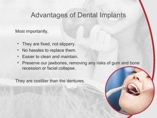 Advantages of Dental Implants
Most importantly,
• They are fixed, not slippery.
• No hassles to replace them.
• Easier to clean and maintain.
• Preserve our jawbones, removing any risks of gum and bone
recession or facial collapse.
They are costilier than the dentures.
 
