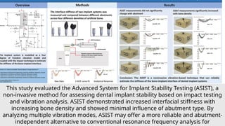 Comprehensive Overview of Dental Implantology: Techniques, Biomechanics ...