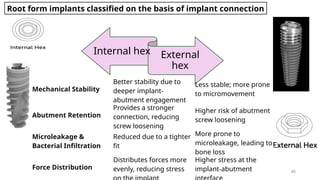 External Hex Connection Comprehensive Overview of Dental Implantology: Techniques, Biomechanics ...