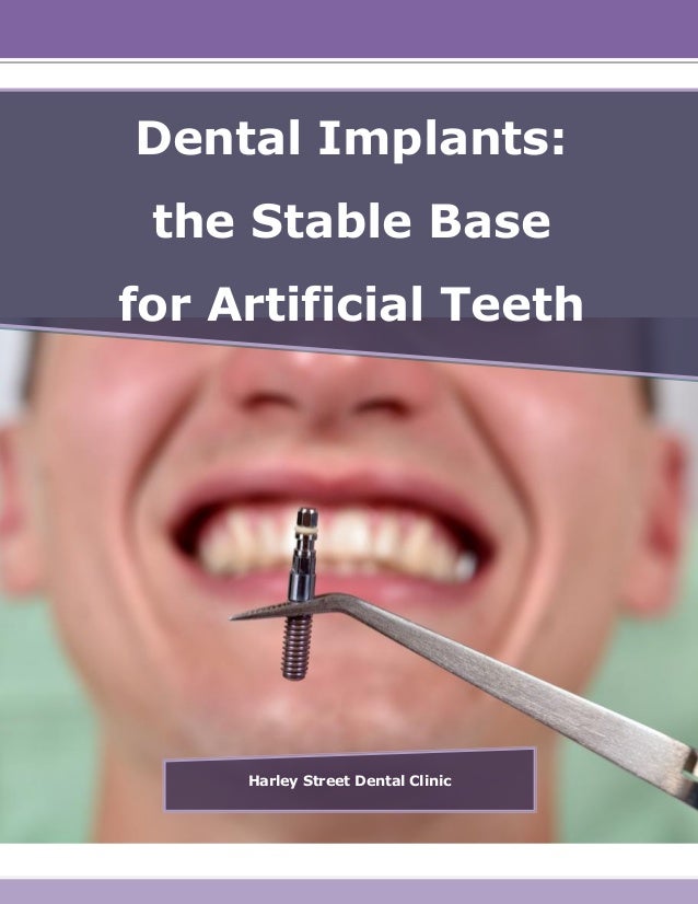 Dental Implants the Stable Base for Artificial Teeth