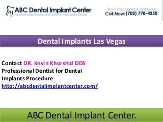 Dental Implants Las Vegas
Contact DR. Kevin Khorshid DDS
Professional Dentist for Dental
Implants Procedure
http://abcdentalimplantcenter.com/
ABC Dental Implant Center.
 