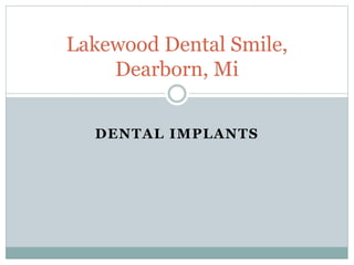 DENTAL IMPLANTS
Lakewood Dental Smile,
Dearborn, Mi
 
