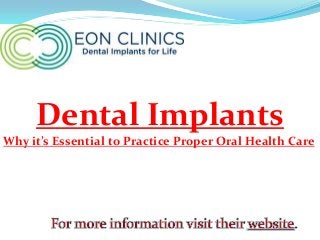 Dental Implants
Why it’s Essential to Practice Proper Oral Health Care

 