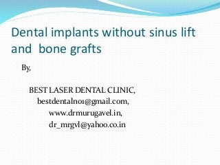 Dental implants without sinus lift
and bone grafts
By,
BEST LASER DENTAL CLINIC,
bestdentalno1@gmail.com,
www.drmurugavel.in,
dr_mrgvl@yahoo.co.in
 