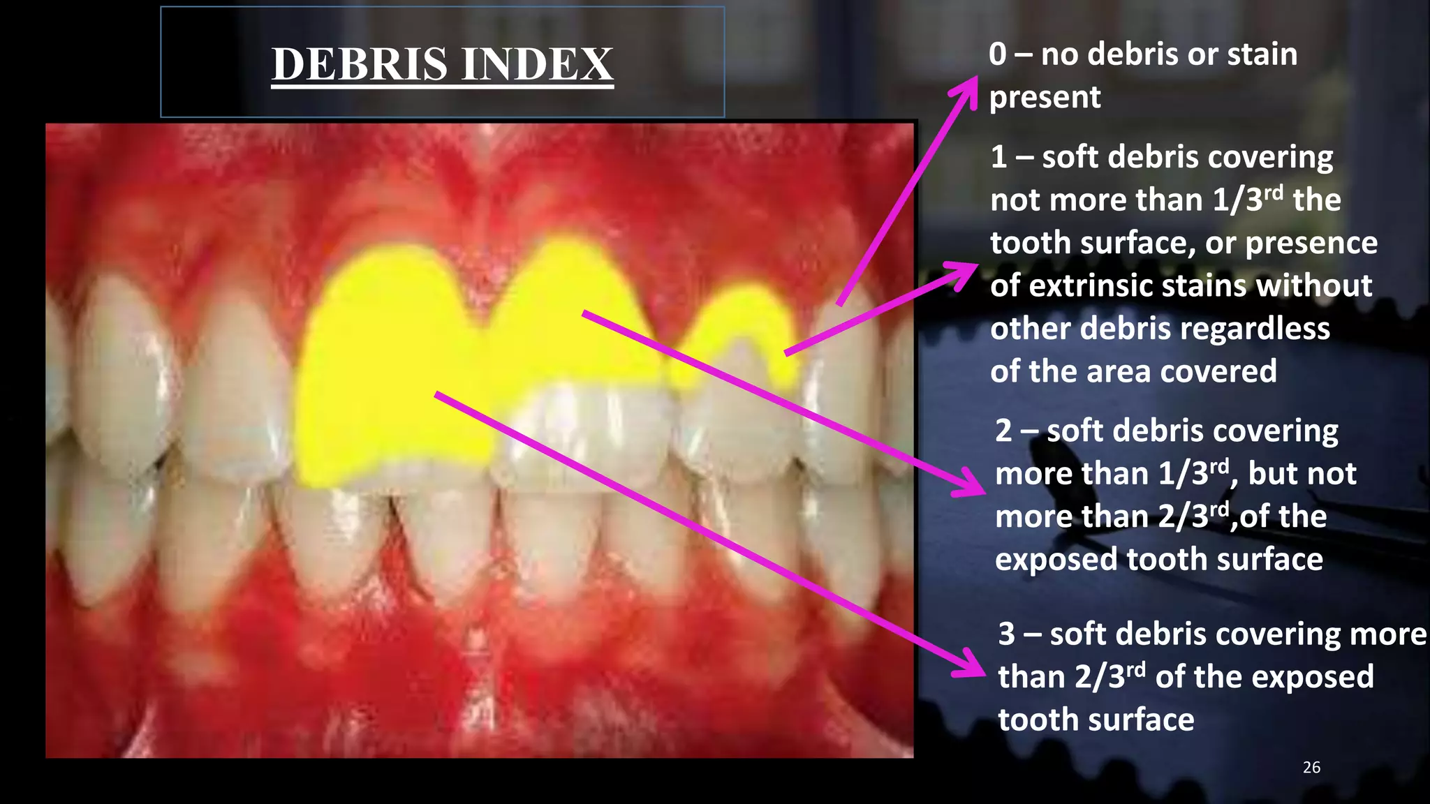Dental indices | PPTX