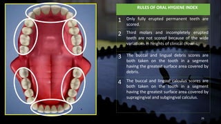 Dental indices | PPTX