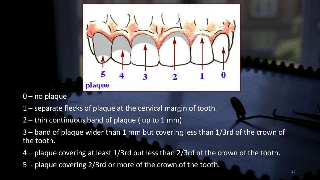 Dental indices
