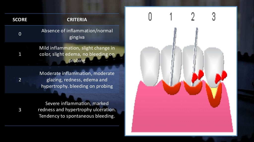 Dental indices