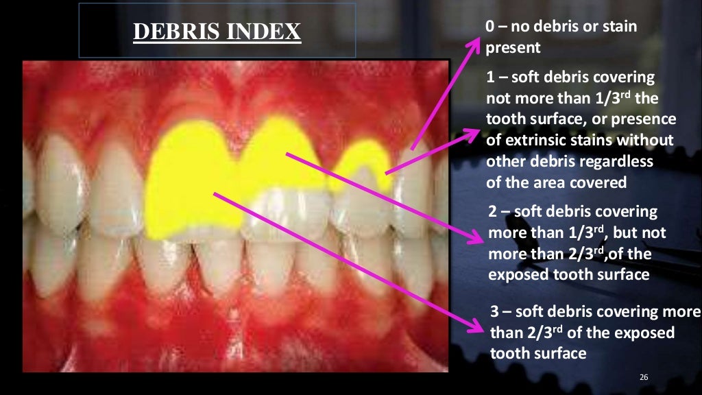 Dental indices