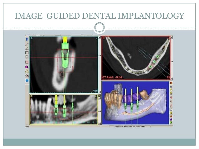 In Vivo Dental Viewer