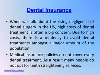 Dental Insurance

 • When we talk about the rising negligence of
   dental surgery in the US, high costs of dental
   treatment is often a big concern. Due to high
   costs, there is a tendency to avoid dental
   treatments amongst a major amount of the
   population.
 • Medical insurance policies do not cover every
   dental treatment. As a result many people do
   not opt for teeth straightening services.
www.drkezian.com
 