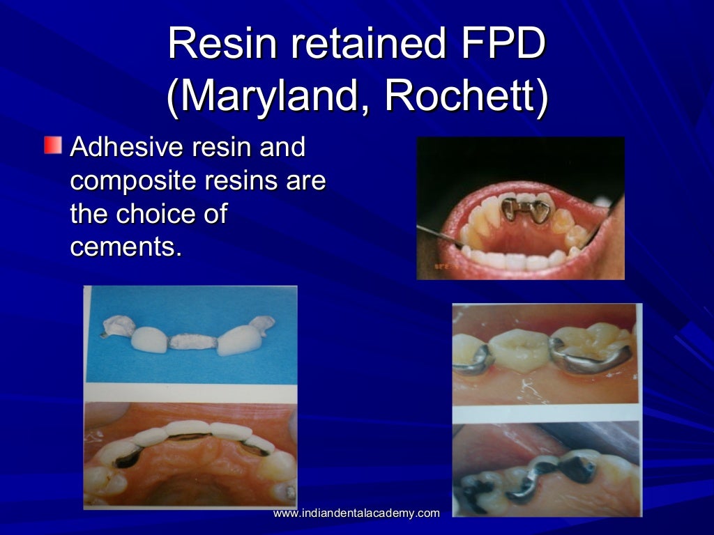 Dental luting cements / oral surgery courses