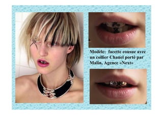 Modèle: facette cousue avec
un collier Chanel porté par
Malin, Agence «Next»
 