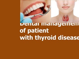 Dental management
of patient
with thyroid disease
 