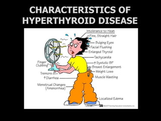 CHARACTERISTICS OF
HYPERTHYROID DISEASE
 