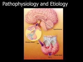 Pathophysiology and Etiology
 