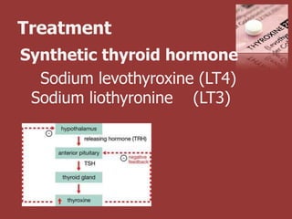 Treatment
Synthetic thyroid hormone
  Sodium levothyroxine (LT4)
 Sodium liothyronine (LT3)
 