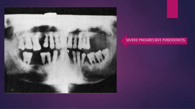 glu test r blood of management patient diabetic Dental a