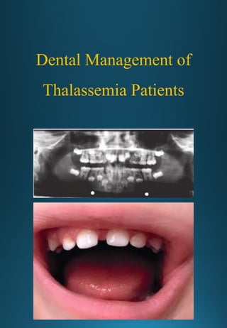 Dental Management of
Thalassemia Patients
 