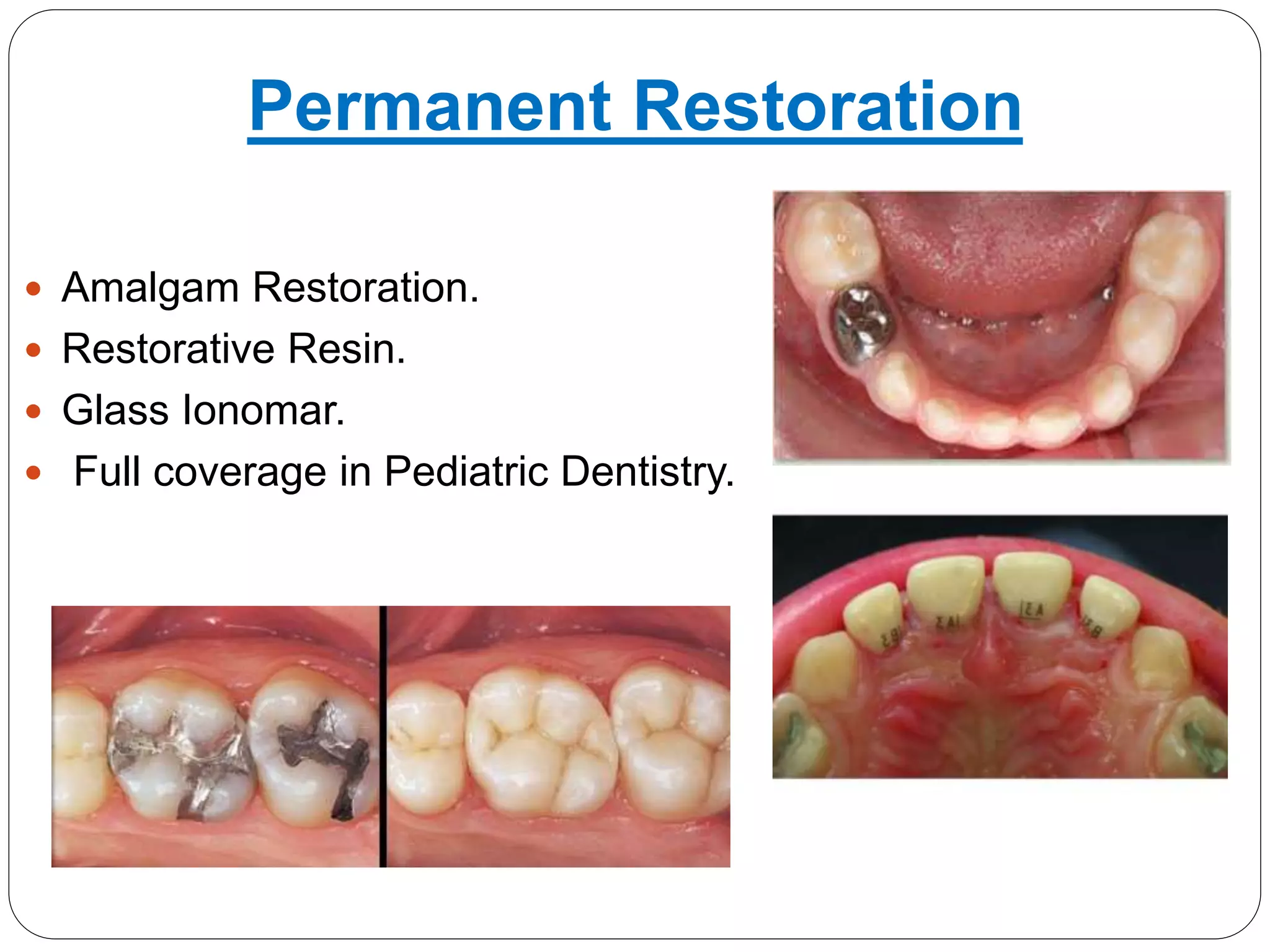 Dental restorative material in pediatric dentistry