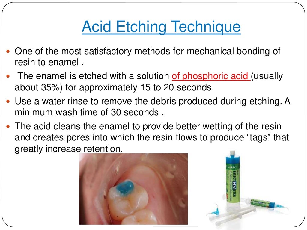 Dental restorative material in pediatric dentistry