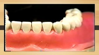 Dental mobility | PPTX