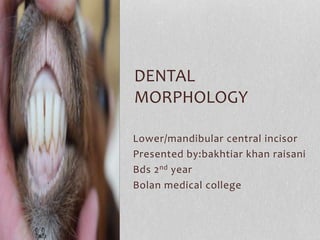 Lower/mandibular central incisor
Presented by:bakhtiar khan raisani
Bds 2nd year
Bolan medical college
DENTAL
MORPHOLOGY
 