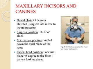 MAXILLARY INCISORS AND
CANINES
 Dental chair:45 degrees
elevated , surgical site is low to
the microscope
 Surgeon position: 11-12 o’
clock
 Microscope position: angled
down the axial plane of the
roots
 Patient head position: occlusal
plane 45 degree to the floor :
patient looking ahead.
 