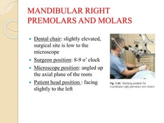 MANDIBULAR RIGHT
PREMOLARS AND MOLARS
 Dental chair: slightly elevated,
surgical site is low to the
microscope
 Surgeon position: 8-9 o’ clock
 Microscope position: angled up
the axial plane of the roots
 Patient head position : facing
slightly to the left
 
