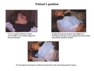 Patient’s position
View of a patient readied for surgery
A travel pillow is an excellent support for
the neck and head
Keeping the head turned mote than slightly for a
Prolonged period may cause torquing of the neck muscles.
This position should be avoided
For the patients and surgeon’s comfort,the patient lies on the side during posterior surgery
 