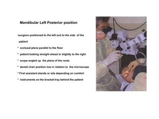 Mandibular Left Posterior position
•surgeon positioned to the left and to the side of the
patient
* occlusal plane parallel to the floor
* patient looking straight ahead or slightly to the right
* scope angled up the plane of the roots
* dental chair position low in relation to the microscope
* First assistant stands or sits depending on comfort
* instruments on the bracket tray behind the patient
 