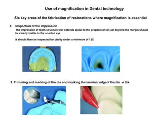 Use of magnification in Dental technology
Six key areas of the fabrication of restorations where magnification is essential
1. Inspection of the impression
the impression of tooth structure that extends apical to the preparation or just beyond the margin should
be clearly visible to the unaided eye
it should then be inspected for clarity under a minimum of 12X
2. Trimming and marking of the die and marking the terminal edgeof the die at 20X
 