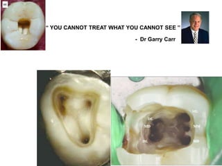 “ YOU CANNOT TREAT WHAT YOU CANNOT SEE ”
- Dr Garry Carr
 
