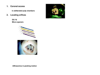 1. Coronal access
in obliterated pulp chambers
2. Locating orifices
DG 16
Micro openers
Ulltrasonics in pecking motion
 
