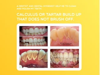 Dental Health Presentation: For Kids | PDF