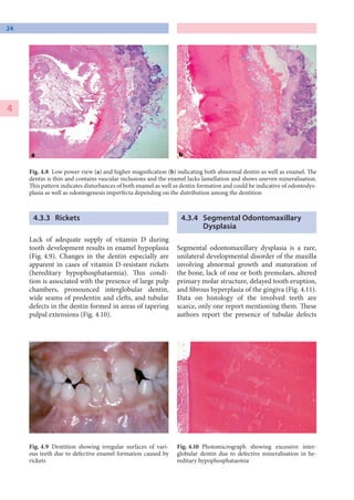 dental-pathology-a-practical-introduction-pieter-j-slootweg-pdf
