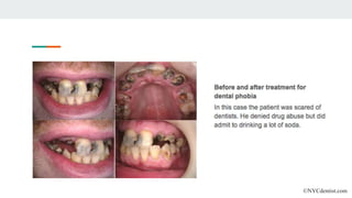 ©NYCdentist.com
 