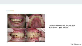 ©NYCdentist.com
This initial treatment took only two hours.
More dentistry is still needed.
 