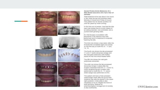 ©NYCdentist.com
 