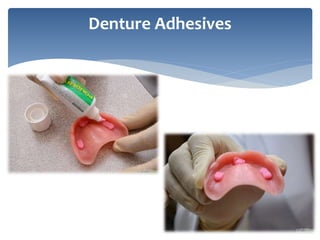 Denture Adhesives
 