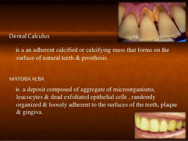 Dental Plaque