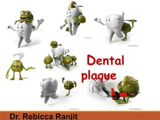 Dental
plaque
Dr. Rebicca Ranjit
 