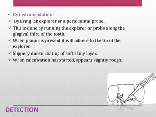 DETECTION
• By instrumentation:
 By using an explorer or a periodontal probe.
 This is done by running the explorer or probe along the
gingival third of the tooth.
 When plaque is present it will adhere to the tip of the
explorer.
 Slippery due to coating of soft slimy layer.
 When calcification has started, appears slightly rough.
 