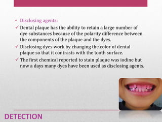 • Disclosing agents:
 Dental plaque has the ability to retain a large number of
dye substances because of the polarity difference between
the components of the plaque and the dyes.
 Disclosing dyes work by changing the color of dental
plaque so that it contrasts with the tooth surface.
 The first chemical reported to stain plaque was iodine but
now a days many dyes have been used as disclosing agents.
DETECTION
 