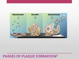 PHASES OF PLAQUE FORMATION2
 